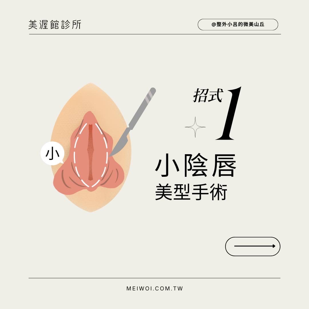 小陰唇美型手術