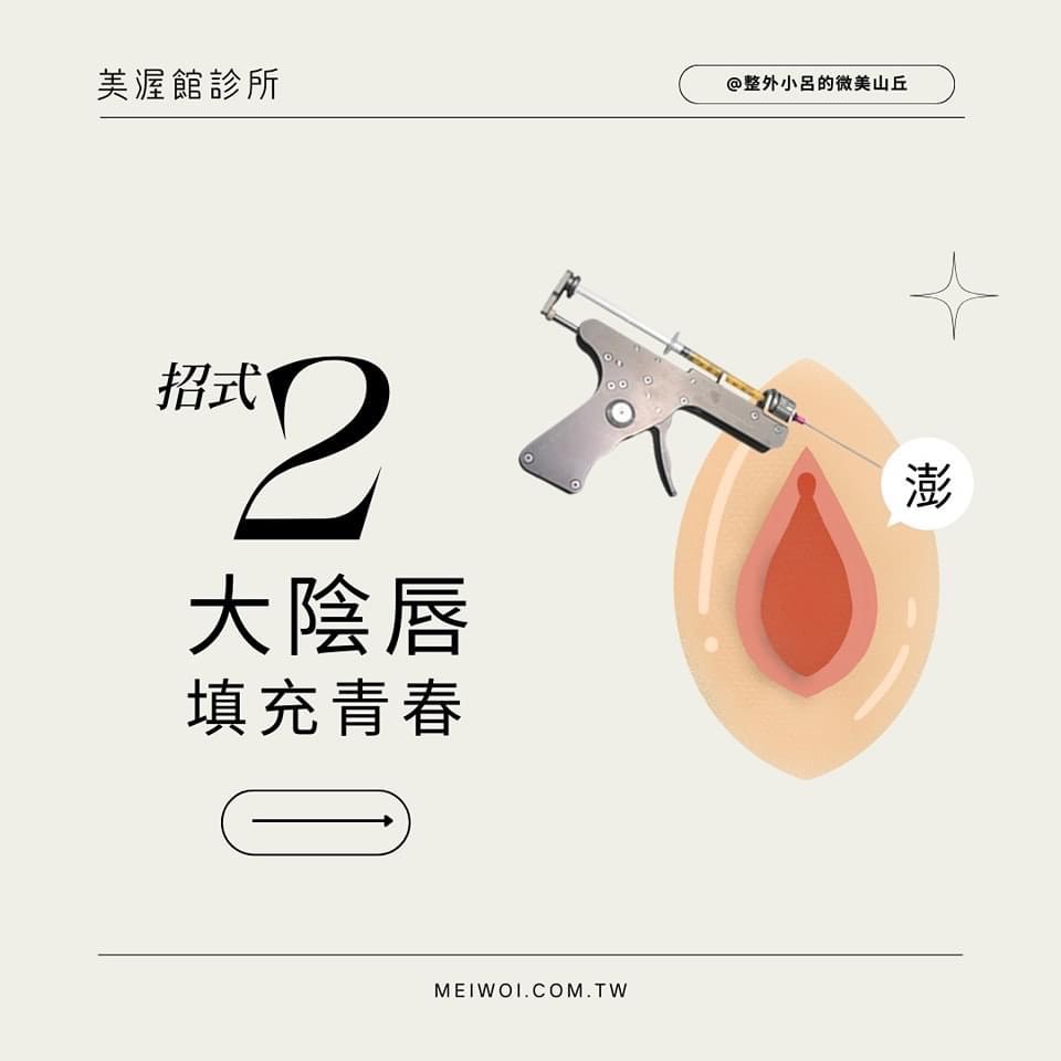 大陰脣填充青春