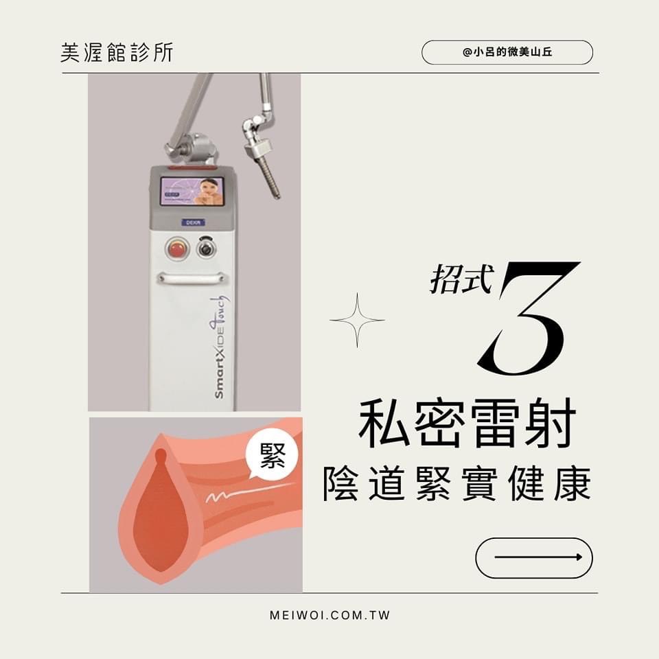 私密處陰道緊實雷射