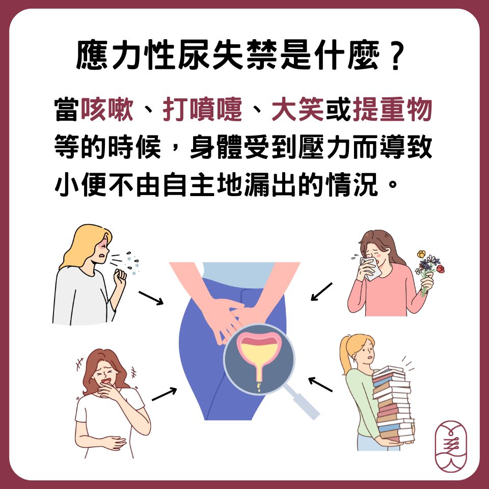 應力性尿失禁是什麼